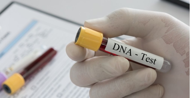 Les meilleurs tests ADN pour chien